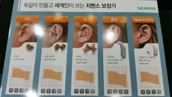 지멘스보청기가격3