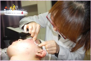 여드름자국치료3