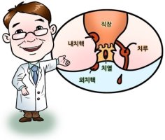 치질사진1
