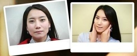 고톡스잘하는곳2