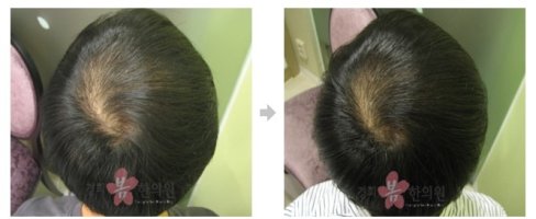 저렴한정신병원2