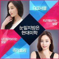 다크써클수술가격2