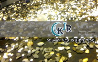 대전성형외과추천2