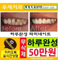 연예인라미네이트3