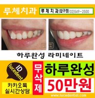 라미네이트연예인5