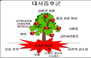 성인병의 근원인 &apos;대사증후군&apos;을 예방하는 3가지 방법!