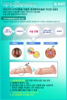 음경확대비용4