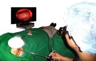 맘모톰수술병원2