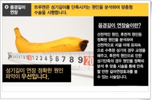 길이연장수술비용3