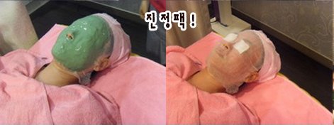 모자이크레이저4