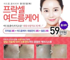 대구수성구피부과1