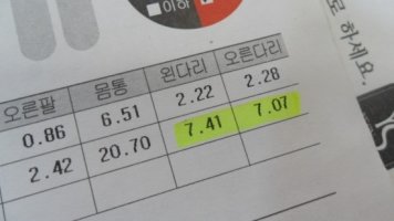 대구허리교정5