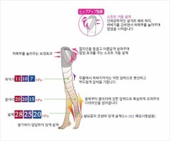압박스타킹파는곳6