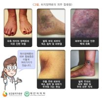 대구하지정맥류4